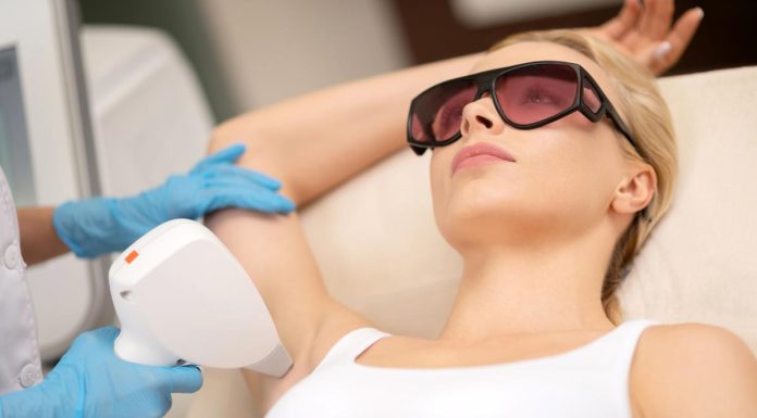 Se poate face epilarea cu laser vara?