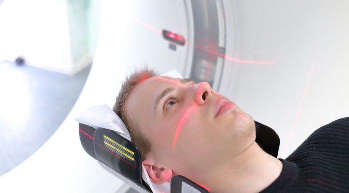 CT-ul cerebral nativ: cand si de ce este recomandat?